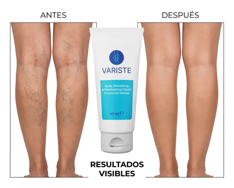 Antes y después: resultados visibles de Variste tras 8 semanas de uso